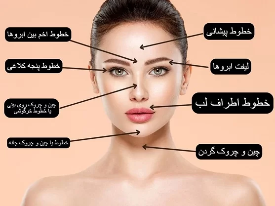 هزینه بوتاکس در ایران: عوامل موثر و مقایسه برندهای معروف از جمله کنتوکس