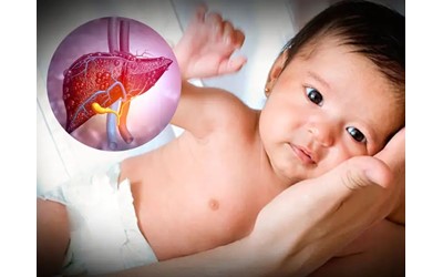 بیماری‌های کبدی در کودکان: هپاتیت ویروسی، اتوایمیون و متابولیک در اصفهان