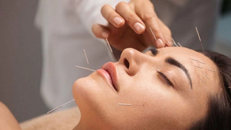 بهترین مرکز متخصص طب سوزنی در اصفهان