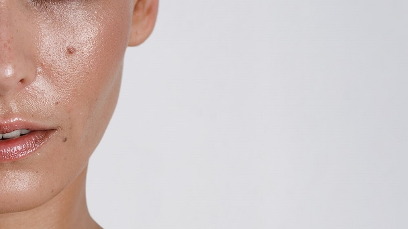 خطرات تشخیص اشتباه پوست چرب یا کم‌آب