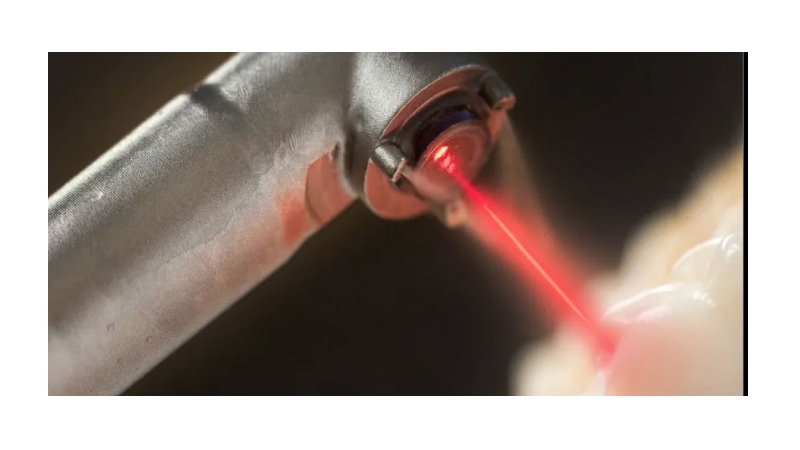 خدمات قابل ارائه در کلینیک لیزر دندان‌پزشکی اصفهان