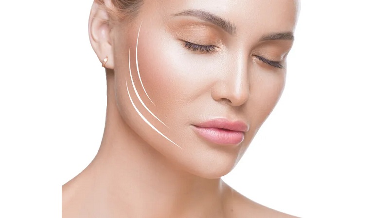 افزایش ماندگاری با مراقبت‌های بعد از جلسات لیزر لیفت و تزریق فیلر