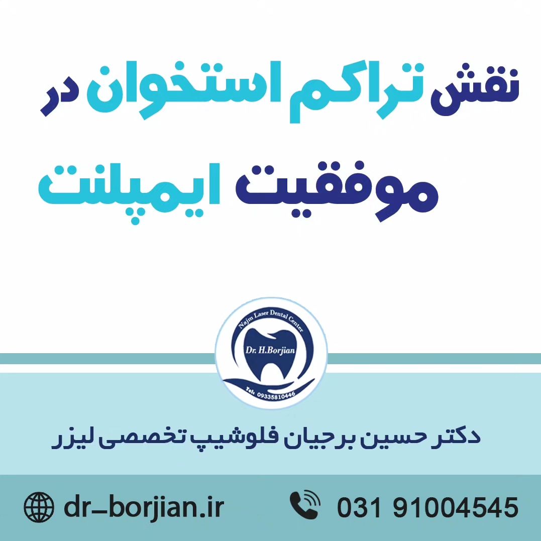 نقش تراکم استخوان در موفقیت ایمپلنت