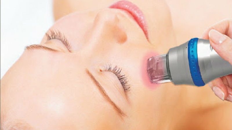 آراف فرکشنال یا سوزنی