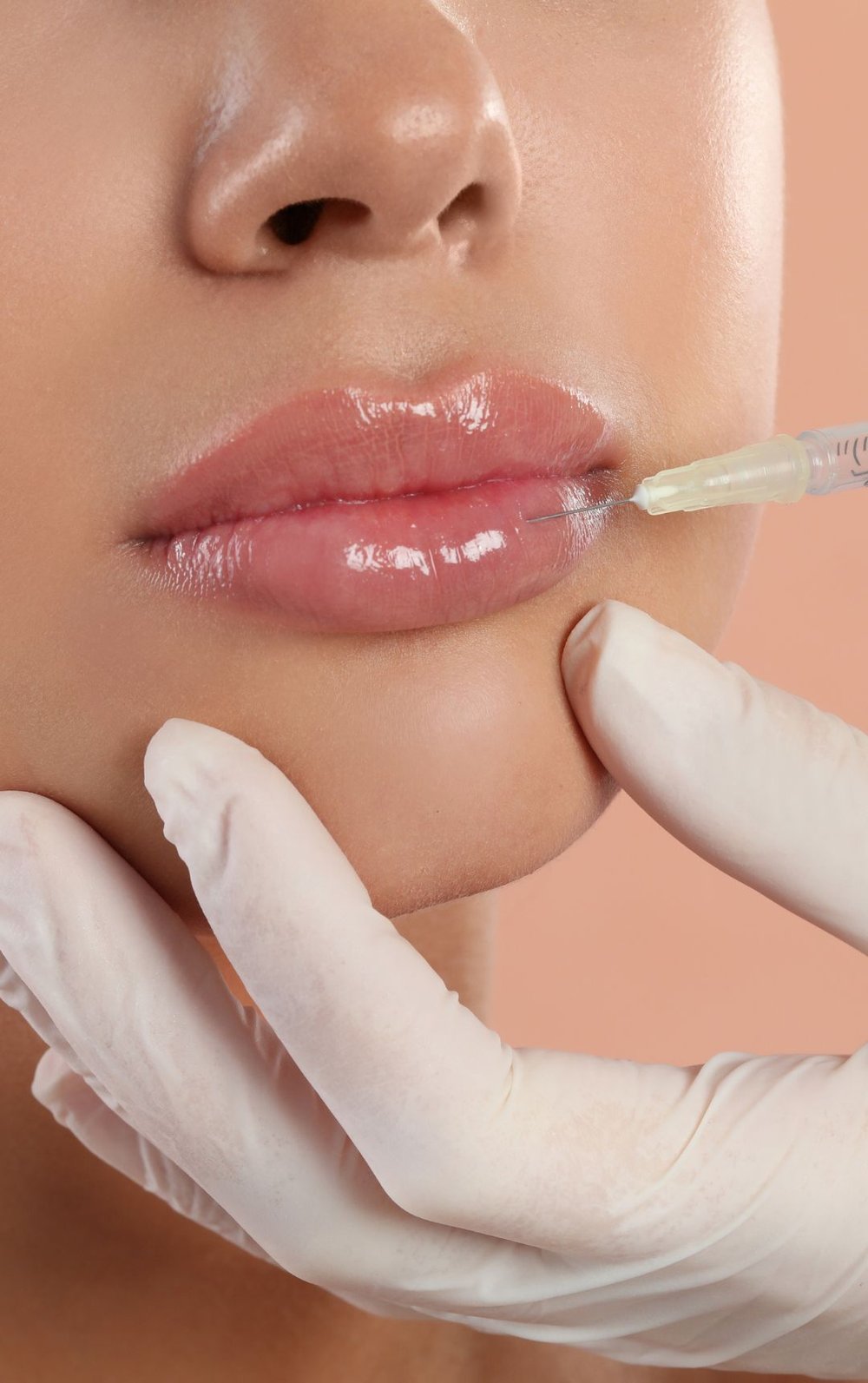 چطور از تخفیف فیلر لب و خط خنده در جشنواره «لبخند یلدایی» استفاده کنیم؟