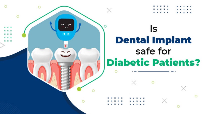 آیا افراد دیابتی می توانند ایمپلنت داشته باشند ؟