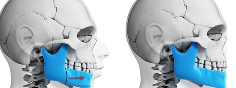 مشکلات تنفسی و فک و صورت | درمان و پیشگیری در اصفهان