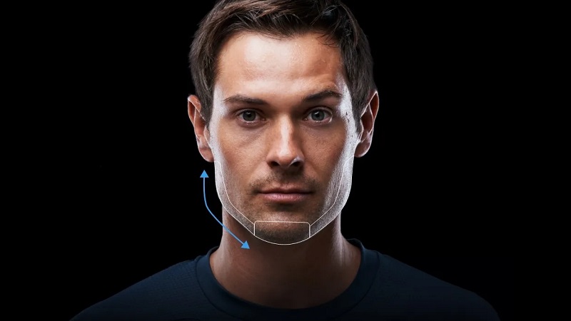 زاویه‌سازی چانه و فک در مردان با فیلر