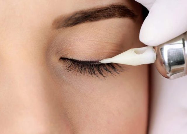 لیزر خط چشم