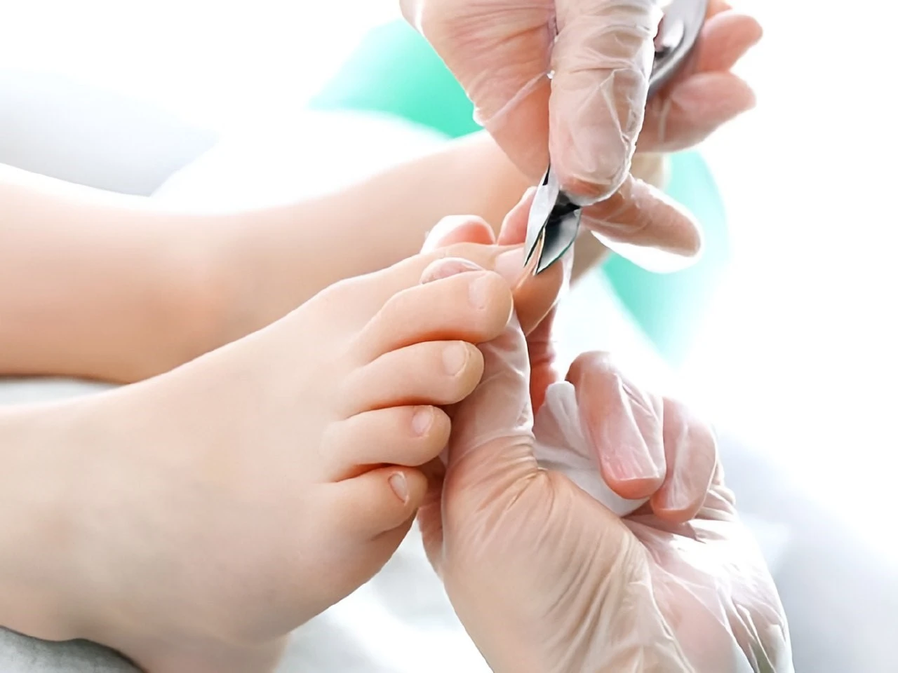 جراحی ناخن