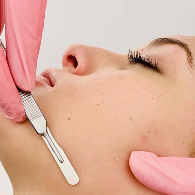 درماپلنینگ