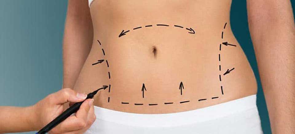 مزو لاغری هرناحیه