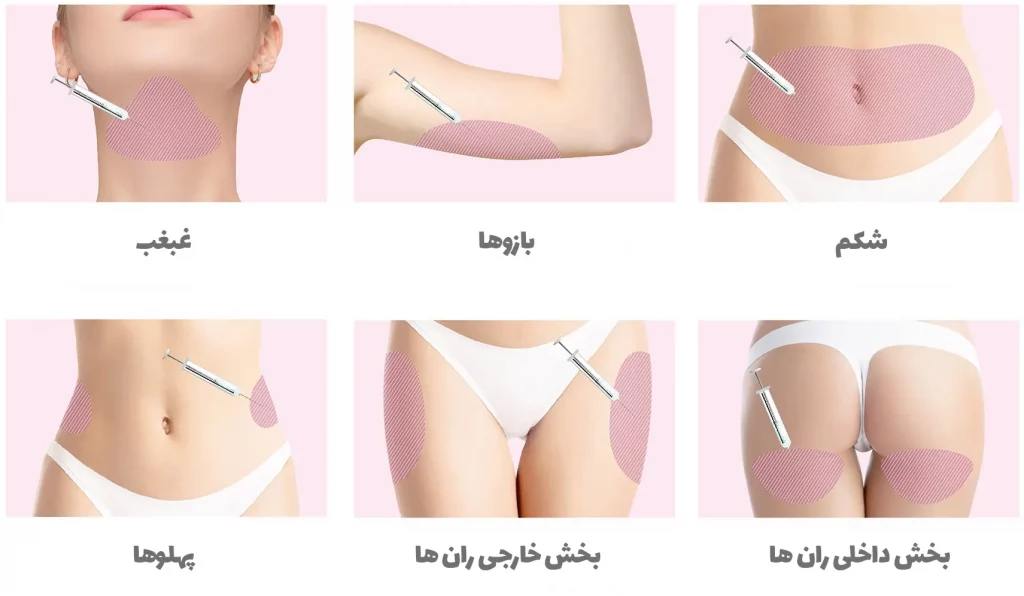 مزوژل چربی سوز اینربی