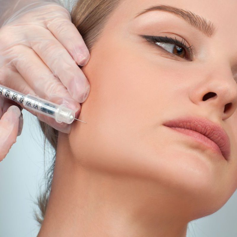 فیلر کره ای