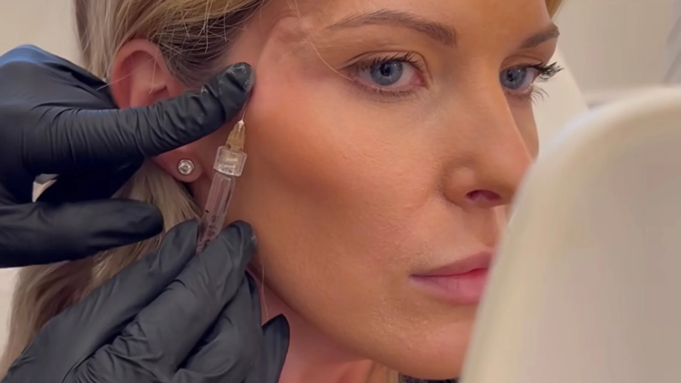 ژل شقیقه{رپلن20)